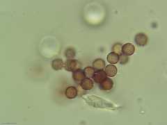 Physarum globuliferum