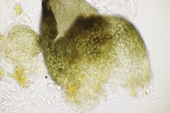 Sphaerellopsis filum