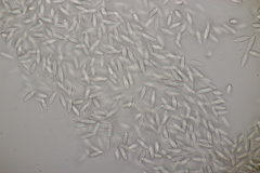 Sphaerellopsis filum