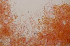 Exidia candida
