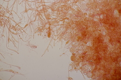 Exidia candida