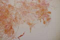 Exidia candida