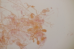 Exidia candida