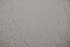 Exidia candida
