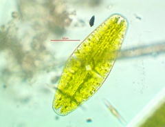 Netrium digitus