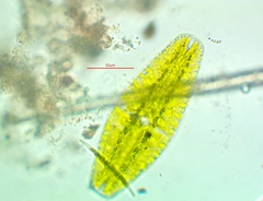 Netrium digitus