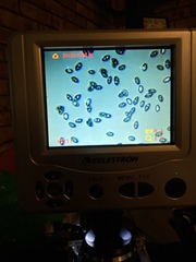 Leucocoprinus brebissonii