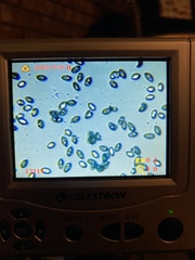 Leucocoprinus brebissonii