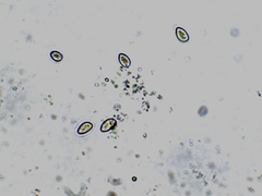 Inocybe subdestricta