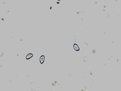 Inocybe subdestricta