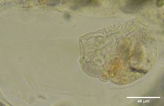 Collotheca