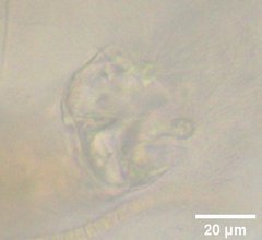Collotheca