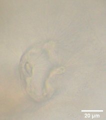 Collotheca