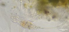 Collotheca