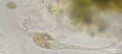 Collotheca