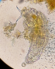 Dissotrocha macrostyla