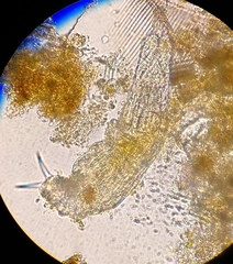 Dissotrocha macrostyla