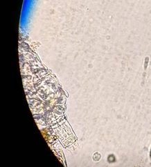 Dissotrocha macrostyla