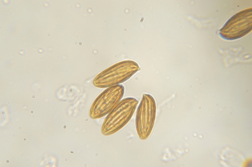 Boletellus ananas image