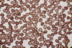 Sphacelotheca hydropiperis