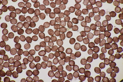 Sphacelotheca hydropiperis