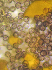 Elaeomyxa reticulospora