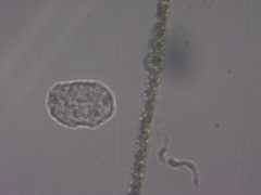 Anabaena