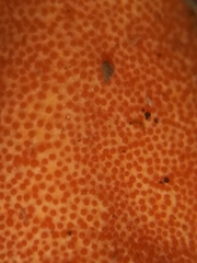 Hypomyces armeniacus