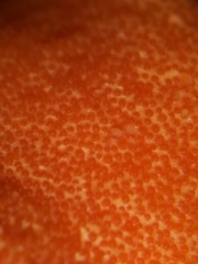 Hypomyces armeniacus