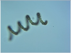 Dolichospermum crassum