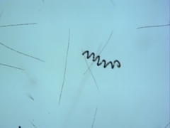 Dolichospermum crassum