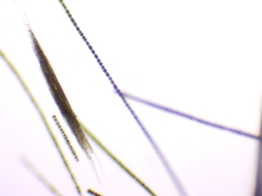Aphanizomenon flosaquae