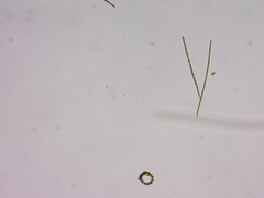 Planktothrix