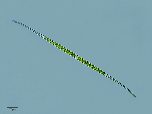 Closterium aciculare — photo 1