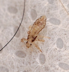 Pediculus humanus capitis