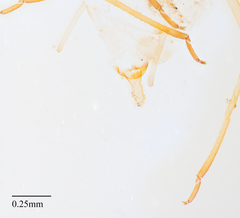 Acyrthosiphon lactucae