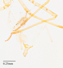 Acyrthosiphon lactucae