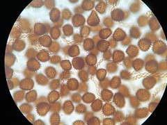 Fossombronia wondraczekii