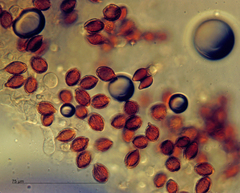 Descomyces