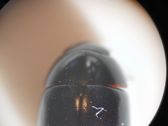 Coelostoma orbiculare