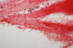 Typhula quisquiliaris