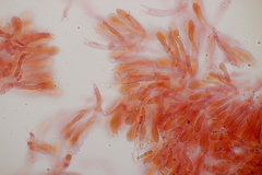 Typhula quisquiliaris