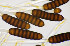 Phragmidium rubi-idaei