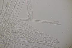 Lachnellula occidentalis