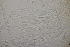 Lachnellula occidentalis