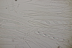 Lachnellula occidentalis