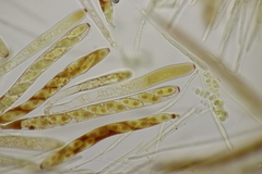 Lachnellula occidentalis