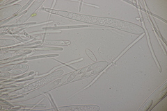 Lachnellula occidentalis