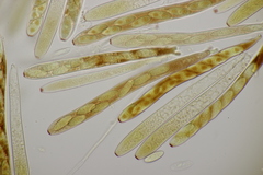 Lachnellula occidentalis
