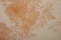 Calocera viscosa